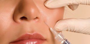 Botox and Filler Injections in Annandale Virginia